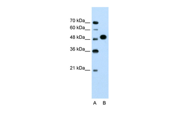 MKRN1 Rabbit Polyclonal Antibody