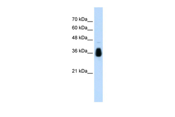 MKRN1 Rabbit Polyclonal Antibody