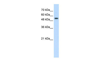 PRPF19 Rabbit Polyclonal Antibody