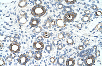 UBE2J1 Rabbit Polyclonal Antibody