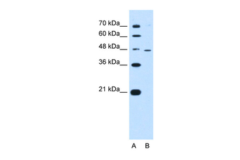 RNF25 Rabbit Polyclonal Antibody