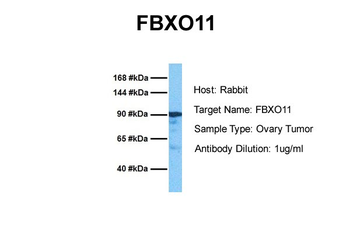 FBXO11 Rabbit Polyclonal Antibody