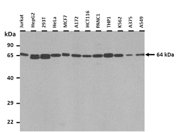 TRIM45 Rabbit Polyclonal Antibody