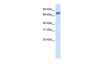 TRIM45 Rabbit Polyclonal Antibody