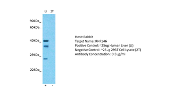 RNF146 Rabbit Polyclonal Antibody