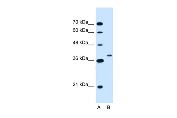 RNF146 Rabbit Polyclonal Antibody