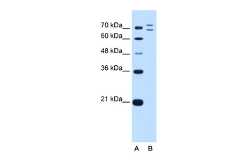RNF168 Rabbit Polyclonal Antibody