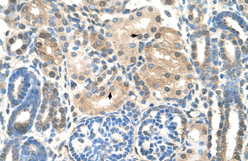 UBE2E2 Rabbit Polyclonal Antibody