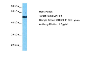 ZNRF4 Rabbit Polyclonal Antibody