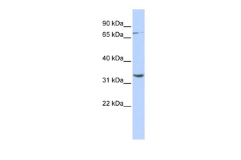 DPY19L1 Rabbit Polyclonal Antibody