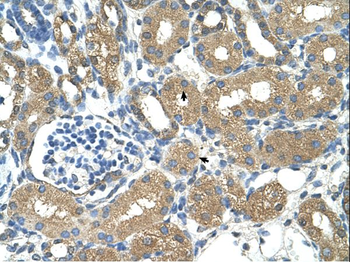 ADH4 Rabbit Polyclonal Antibody