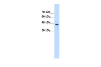 PCYT2 Rabbit Polyclonal Antibody