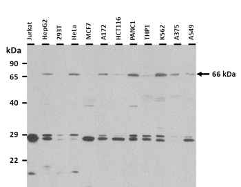 OPTN Rabbit Polyclonal Antibody