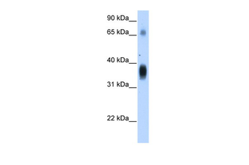 NOV Rabbit Polyclonal Antibody