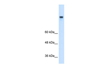 MTTP Rabbit Polyclonal Antibody