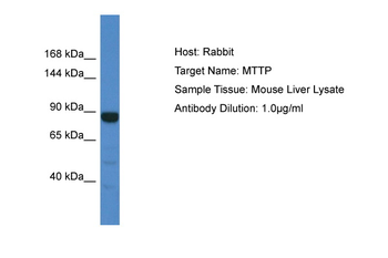 MTTP Rabbit Polyclonal Antibody