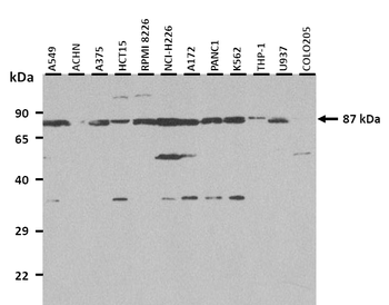 TAP1 Rabbit Polyclonal Antibody