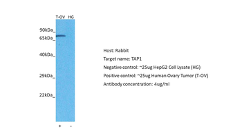 TAP1 Rabbit Polyclonal Antibody