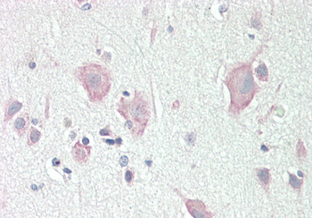DLG2 Rabbit Polyclonal Antibody
