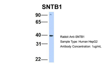 SNTB1 Rabbit Polyclonal Antibody