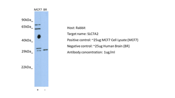 SLC7A2 Rabbit Polyclonal Antibody