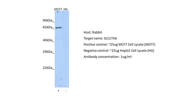 SLC27A6 Rabbit Polyclonal Antibody