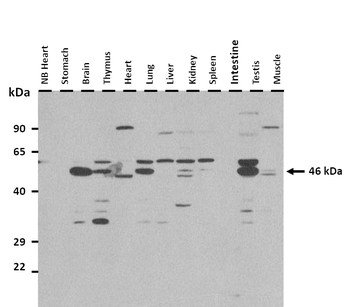SLC37A4 Rabbit Polyclonal Antibody