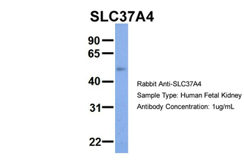 SLC37A4 Rabbit Polyclonal Antibody