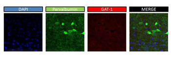 SLC6A1 Rabbit Polyclonal Antibody