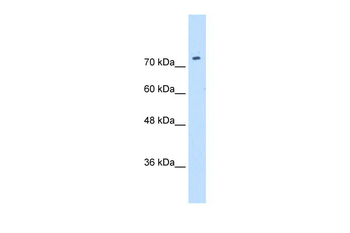SLC7A1 Rabbit Polyclonal Antibody