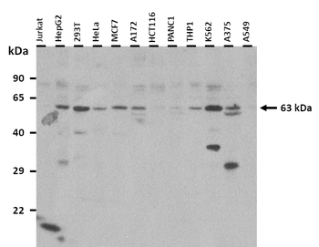 SLC22A2 Rabbit Polyclonal Antibody