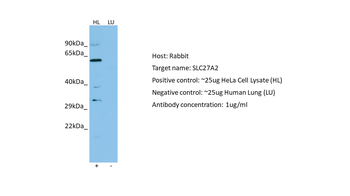 SLC27A2 Rabbit Polyclonal Antibody