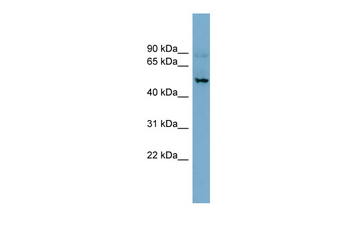 SLC1A1 Rabbit Polyclonal Antibody