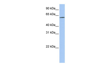 SLC22A14 Rabbit Polyclonal Antibody