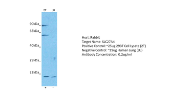 SLC27A4 Rabbit Polyclonal Antibody