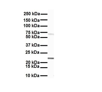 SLC27A4 Rabbit Polyclonal Antibody