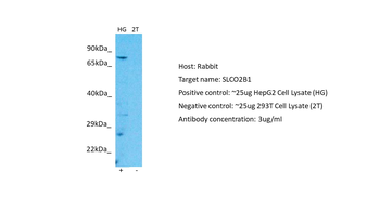 SLCO2B1 Rabbit Polyclonal Antibody