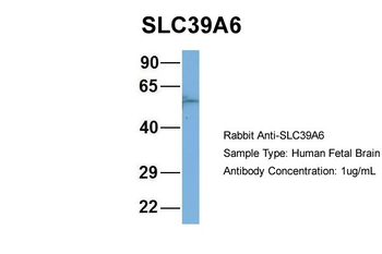 SLC39A6 Rabbit Polyclonal Antibody