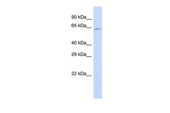 SLC25A12 Rabbit Polyclonal Antibody
