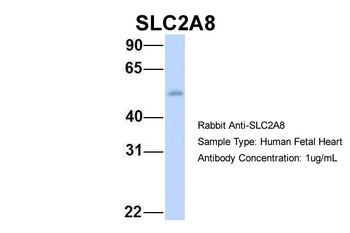 SLC2A8 Rabbit Polyclonal Antibody