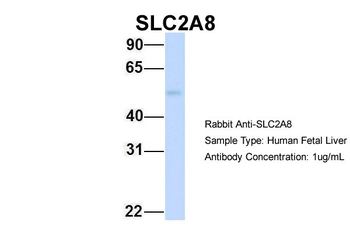 SLC2A8 Rabbit Polyclonal Antibody