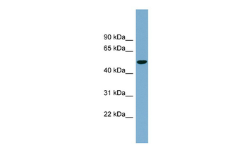 SLC2A8 Rabbit Polyclonal Antibody