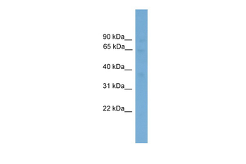 SLC40A1 Rabbit Polyclonal Antibody