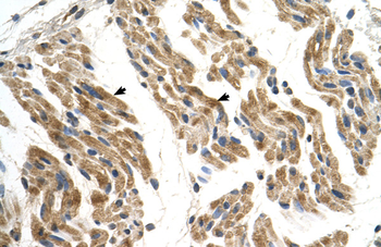 SLC35F2 Rabbit Polyclonal Antibody
