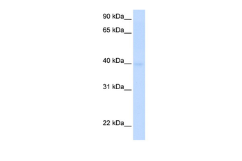 SLC25A36 Rabbit Polyclonal Antibody