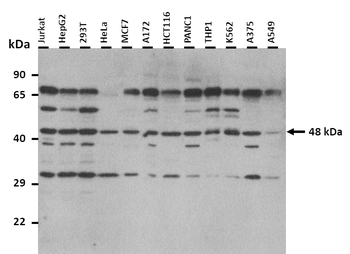 SLC22A3 Rabbit Polyclonal Antibody