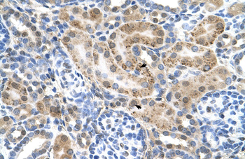 SLC22A3 Rabbit Polyclonal Antibody