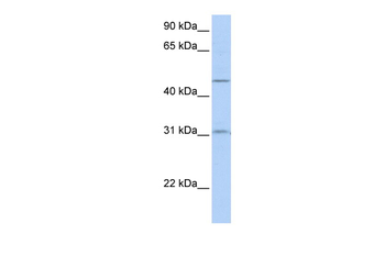 SLC39A11 Rabbit Polyclonal Antibody