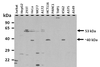 SLC36A2 Rabbit Polyclonal Antibody
