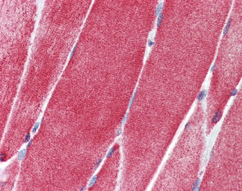 SLC36A2 Rabbit Polyclonal Antibody